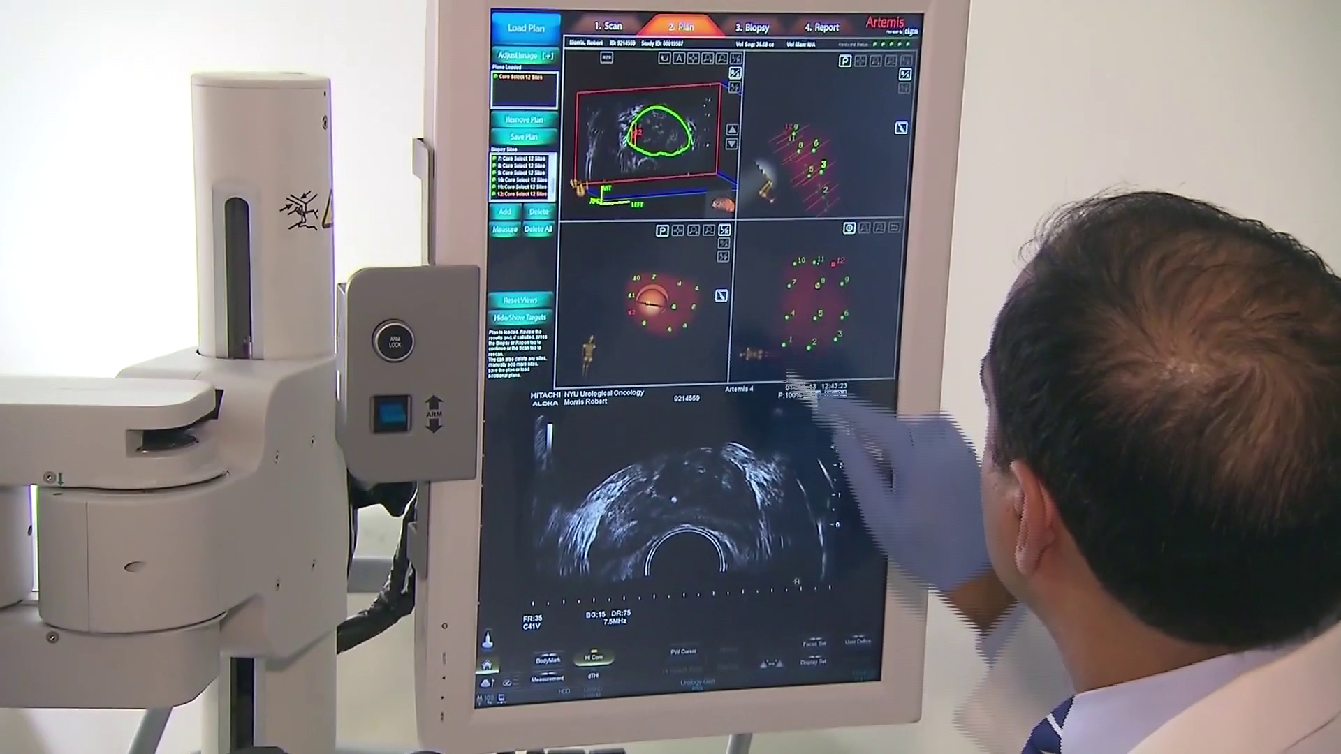 Why is colorectal cancer aggressive in younger patients? Researchers discover new clues — WESH 2 Orlando