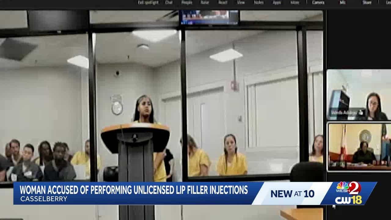 Woman accused of performing unlicensed lip filler injections out of Casselberry business — WESH 2 Local Orlando, Winter Park Health news